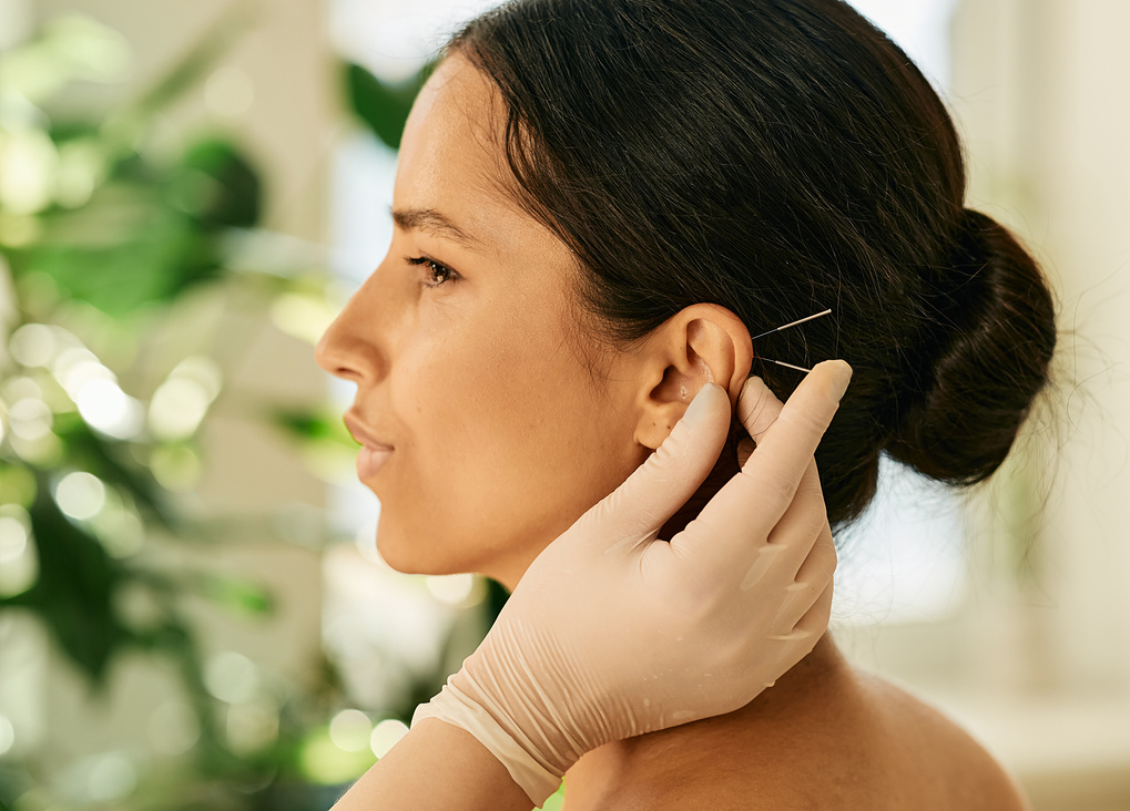 Woman having ear acupressure or ear acupuncture for her diseases treatment, side view. Acupuncture, reflexology, traditional Chinese medicine